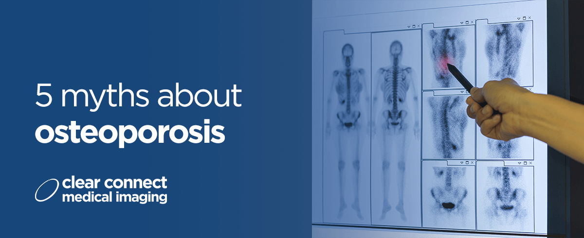 5 myths about osteoporosis 