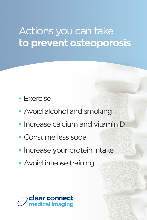 Myth #1: There is nothing you can do to prevent osteoporosis 